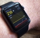 В новой версии WatchOS будет непрерывный мониторинг глюкозы