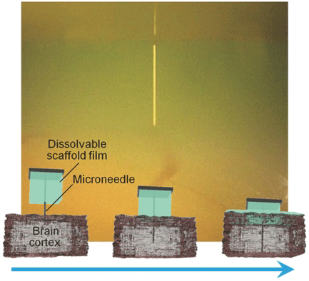 dissolvable-base-scaffolds