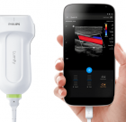 Philips получил одобрение FDA для мобильного УЗИ