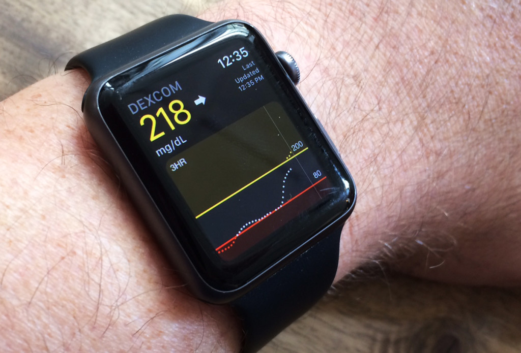 dexcom samsung watch